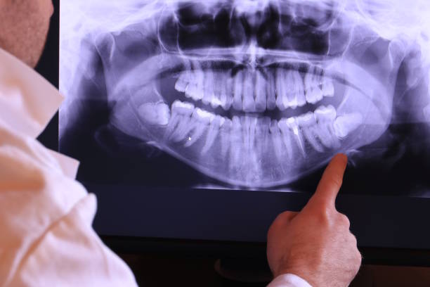 Best Broken or Cracked Tooth Emergency Dentist in East Wenatchee, WA